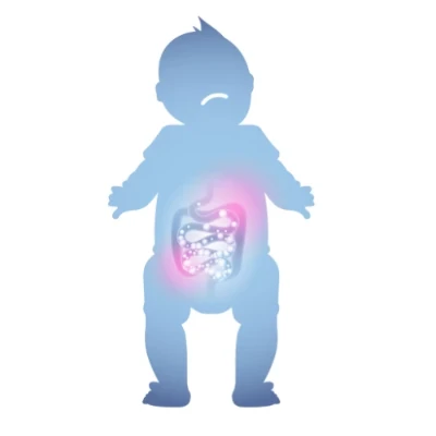 Ilustração do trato digestivo de um bebê com cólica